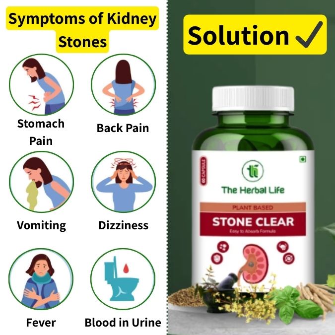 Stone Clear | Natural Kidney Stone Support (Pack of 2)